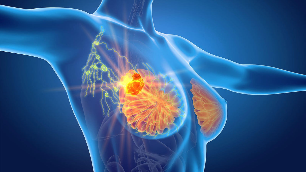 iSelfTest Breast Cancer Risk