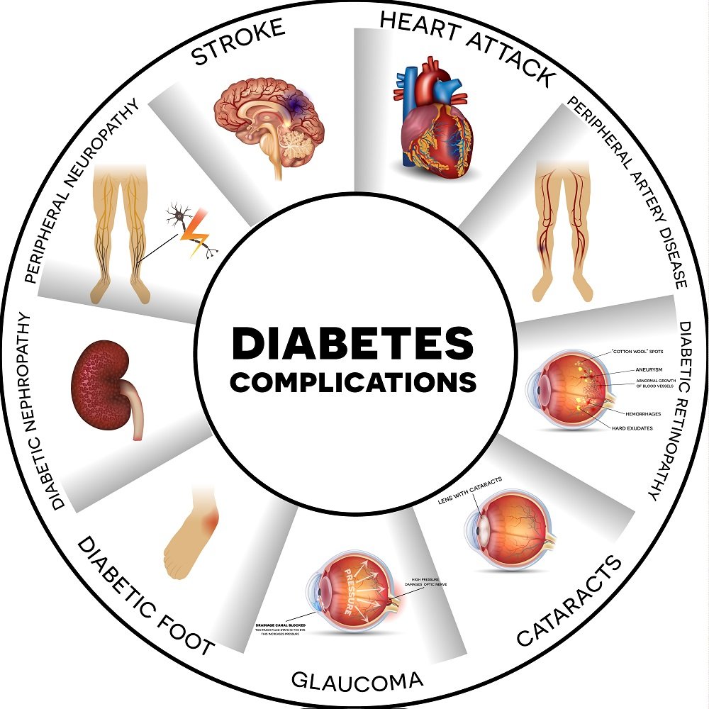 iSelfTest Diabetes Risk (NGS)