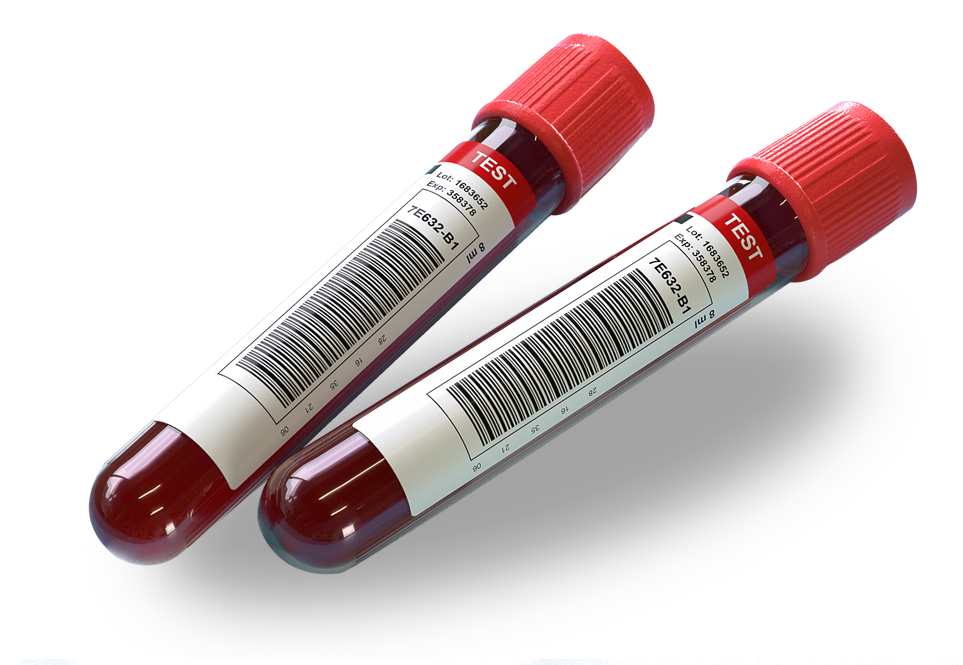 Alprazolam, Whole Blood