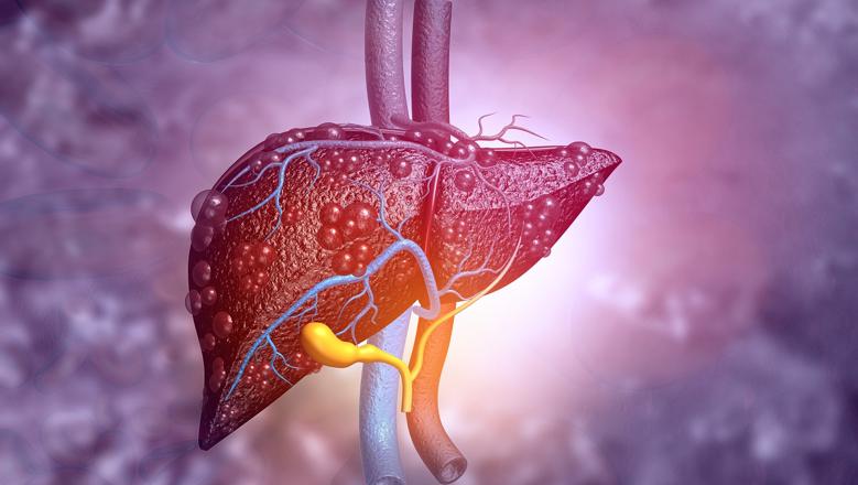 iSelfTest Fatty Liver Risk