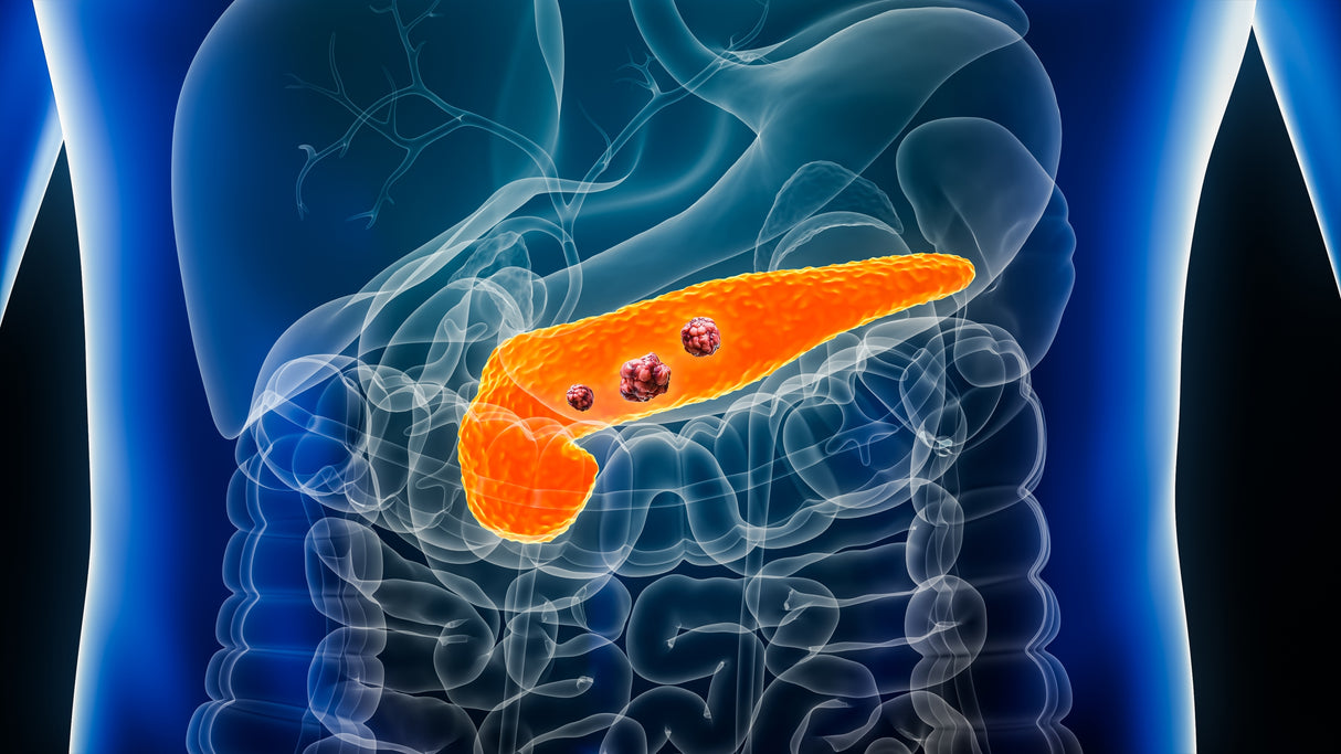 iSelfTest Pancreatic Cancer Risk
